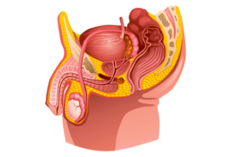 阴茎延长手术后缝线排异，红肿刺痛难忍?