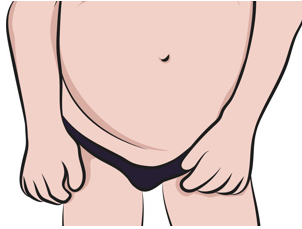 阴茎延长功能未改善反恶化,得不偿失? 阴茎延长功能未改善反恶化,得不偿失?