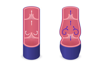 阴茎延长手术后老年皮肤松弛,延长部位下垂更尴尬? 阴茎延长手术后老年皮肤松弛,延长部位下垂更尴尬?